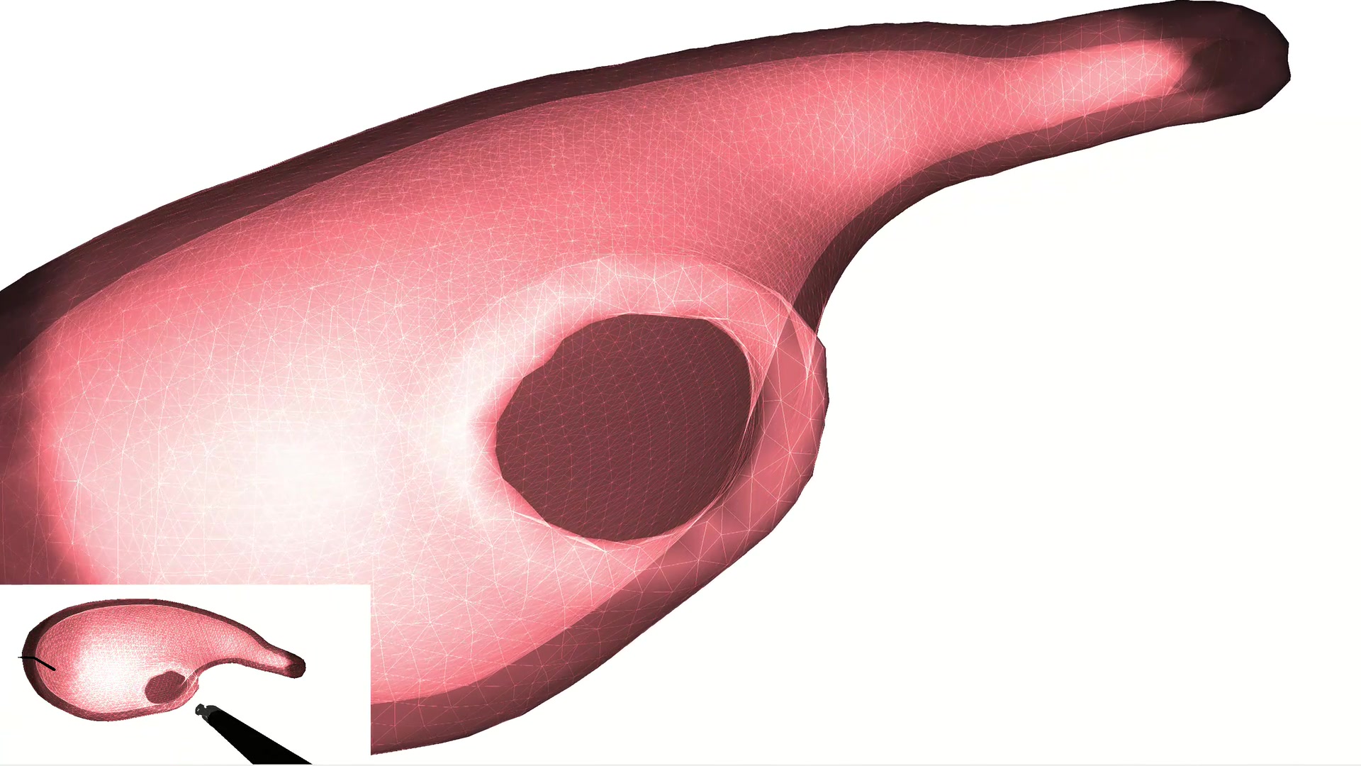 Finite-element contact-rich stomach simulation