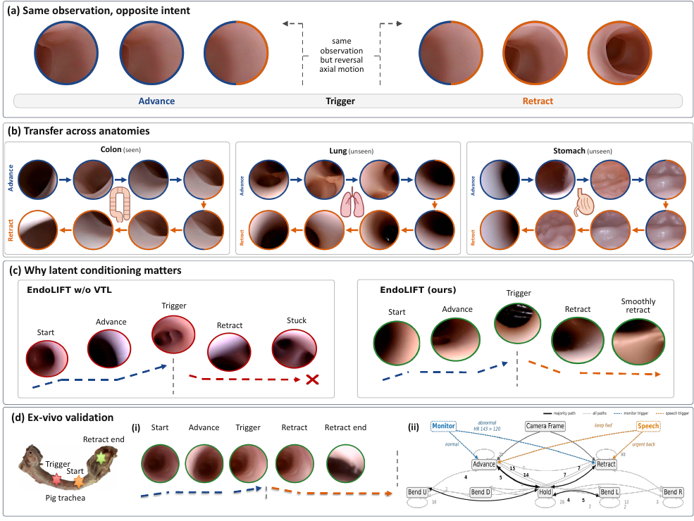 EndoLIFT experimental results
