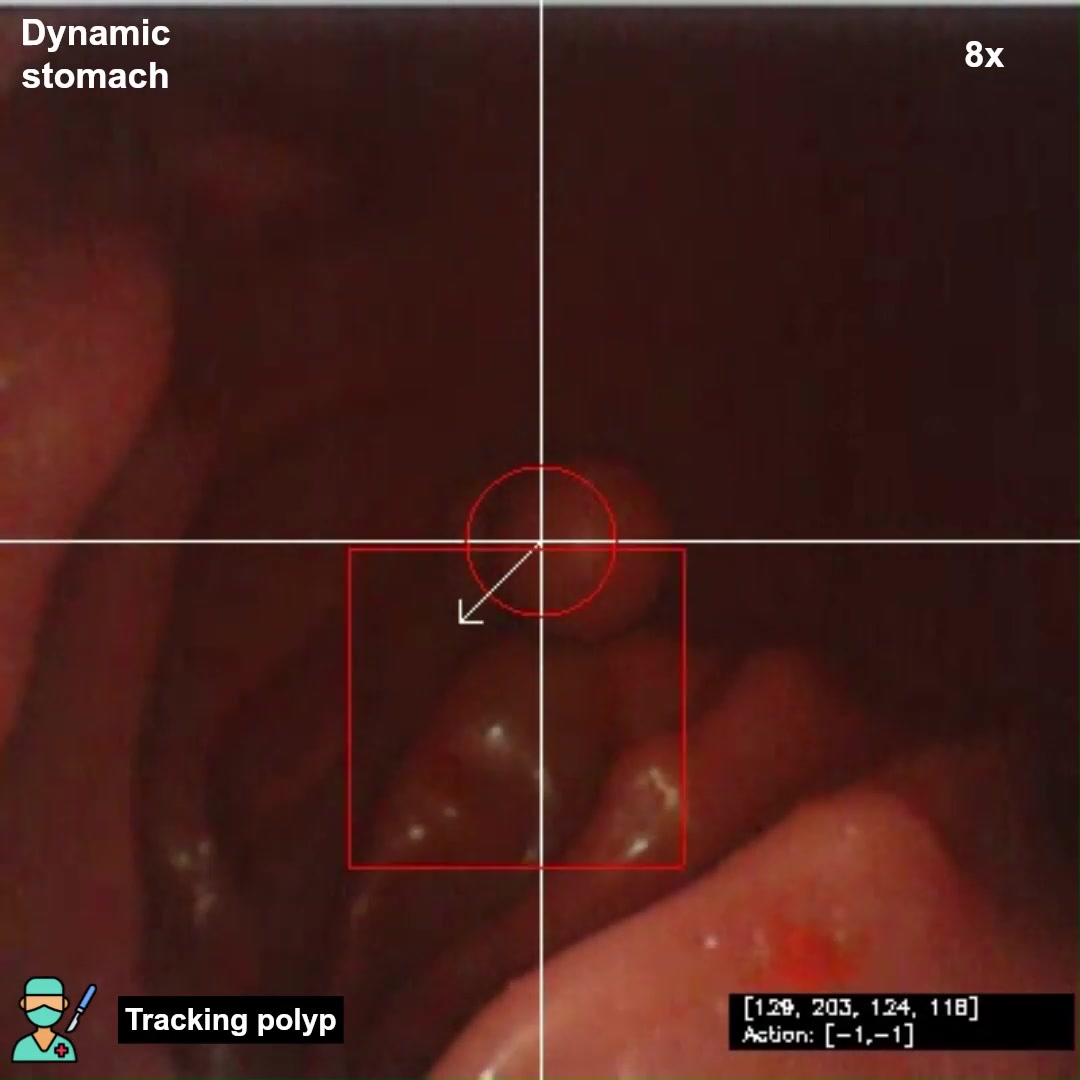 EndoVLA tracking a polyp